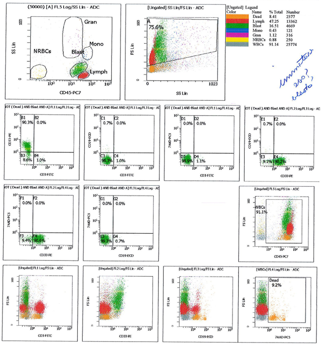 Flow cytometry of the FNA from pelvic lymph node showing population of CD33+ blasts with no expression of CD3 or CD19